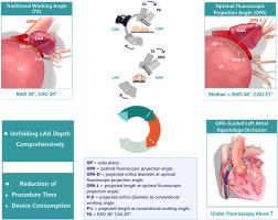 Efficiency of optimal fluoroscopic projection angle defined by computed tomography angiography for left atrial appendage closure