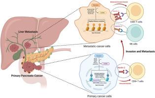 Histone lactylation dynamics: Unlocking the triad of metabolism, epigenetics, and immune regulation in metastatic cascade of pancreatic cancer