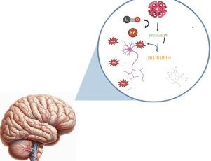 Investigating bilirubin concentrations in schizophrenia: A systematic review and meta-analysis