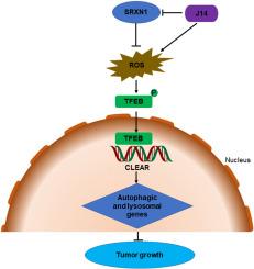 Sulfiredoxin-1 promotes the growth of hepatocellular carcinoma by inhibiting TFEB-mediated autophagy and lysosome biogenesis