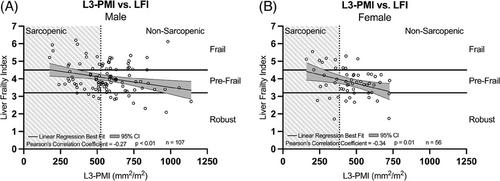 Comparing Functional Frailty and Radiographic Sarcopenia as Predictors of Outcomes After Liver Transplant