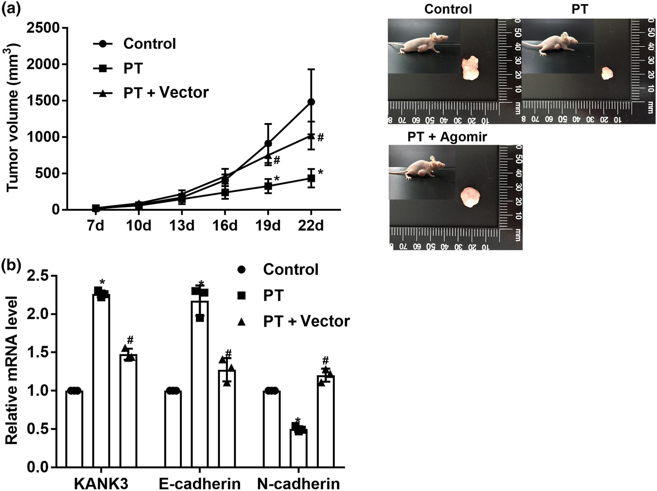 Pterostilbene exerts anti-lung squamous cell carcinoma function by suppressing the level of KANK3