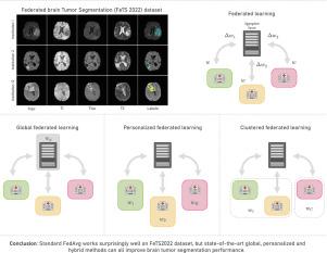 Federated brain tumor segmentation: An extensive benchmark