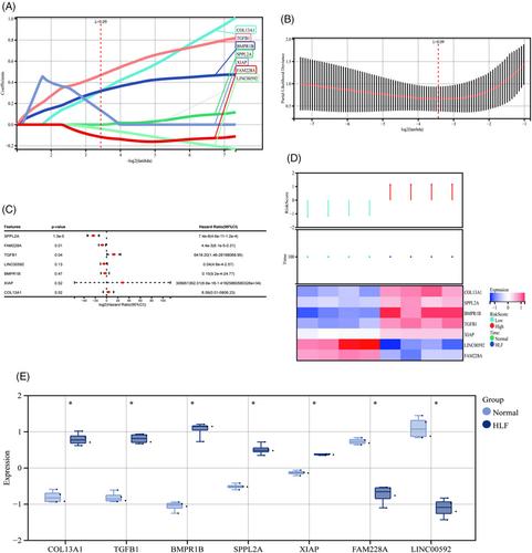 Experimental confirmation and bioinformatics reveal biomarkers of immune system infiltration and hypertrophy ligamentum flavum