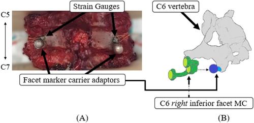 Facet deflection and strain are dependent on axial compression and distraction in C5–C7 spinal segments under constrained flexion