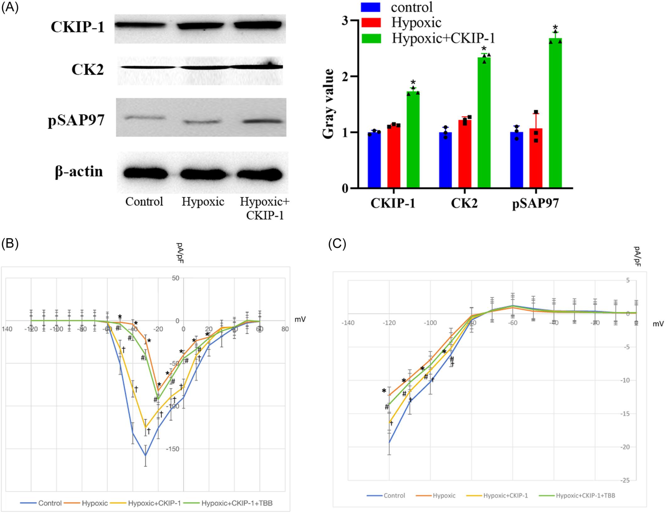 CKIP-1 mediates CK2 translocation to regulate Nav1.5 and Kir2.1 channel complexes in cardiomyocytes