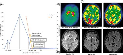 Parkinson-like neurotoxicity in female patients treated with idecabtagene-vicleucel