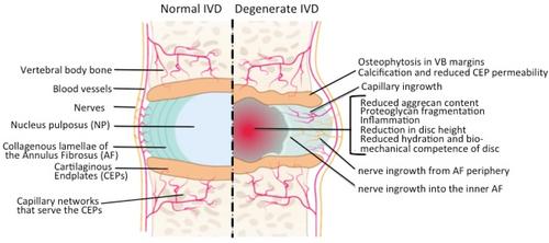 Diverse and multifunctional roles for perlecan (HSPG2) in repair of the intervertebral disc