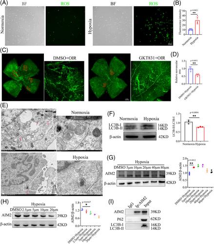 Autophagy-mediated activation of the AIM2 inflammasome enhances M1 polarization of microglia and exacerbates retinal neovascularization