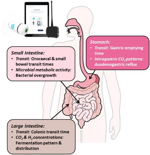 Recent advances in measuring the effects of diet on gastrointestinal physiology: Sniffing luminal gases and fecal volatile organic compounds