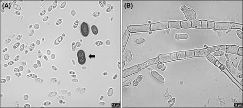 Advances in Aureobasidium research: Paving the path to industrial utilization