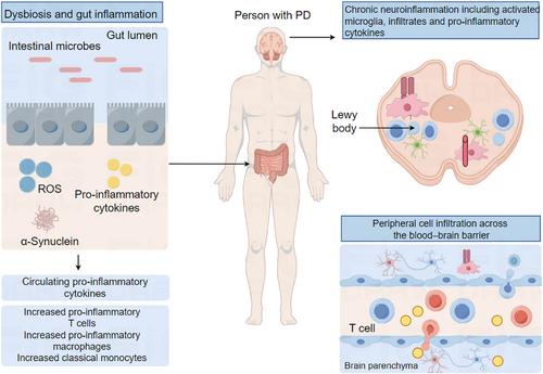 Overcoming challenges of clinical cell therapies for Parkinson's disease with photobiomodulation
