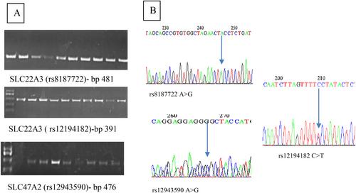 The Influence of OCT3 and MATE2 Genetic Polymorphisms in Poor Response to Metformin in Type 2 Diabetes Mellitus