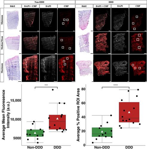 Collagen integrity of the annulus fibrosus in degenerative disc disease individuals quantified with collagen hybridizing peptide