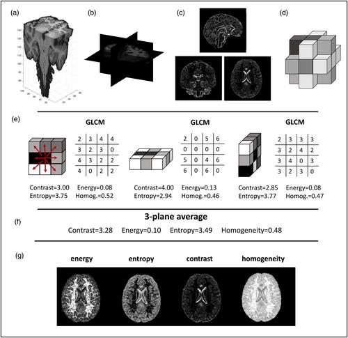 Texture-based morphometry in relation to apolipoprotein ε4 genotype, ageing and sex in a midlife population