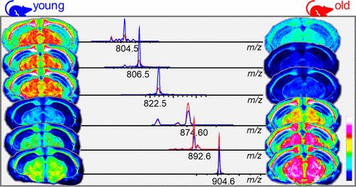 Applying Spatial Metabolomics To Investigate Age- and Drug-Induced Neurochemical Changes