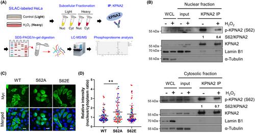 Oxidative stress mediates nucleocytoplasmic shuttling of KPNA2 via AKT1-CDK1 axis-regulated S62 phosphorylation