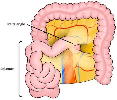 Jejunum free flap for head and neck reconstruction, a step-by-step surgical technique videos