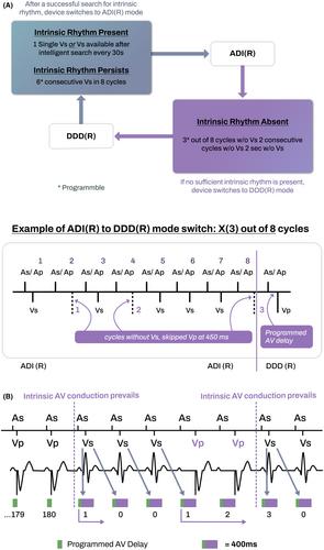 Evaluation of ventricular pacing suppression algorithms in dual chamber pacemaker: Results of “LEADER” study