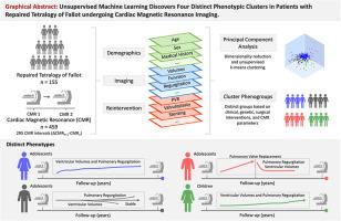 Phenotypic clustering of repaired Tetralogy of Fallot using unsupervised machine learning