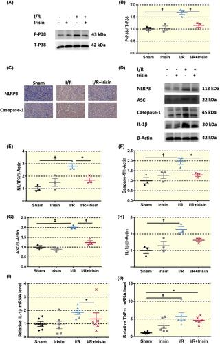 Irisin preserves mitochondrial integrity and function in tubular epithelial cells after ischemia–reperfusion-induced acute kidney injury