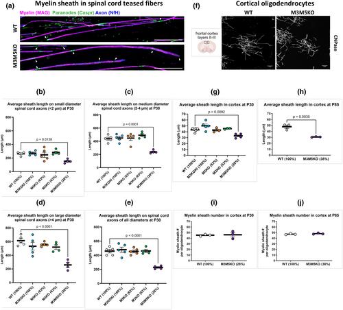 Myelin basic protein mRNA levels affect myelin sheath dimensions, architecture, plasticity, and density of resident glial cells