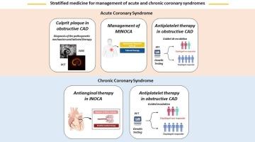 Stratified medicine for acute and chronic coronary syndromes: A patient-tailored approach