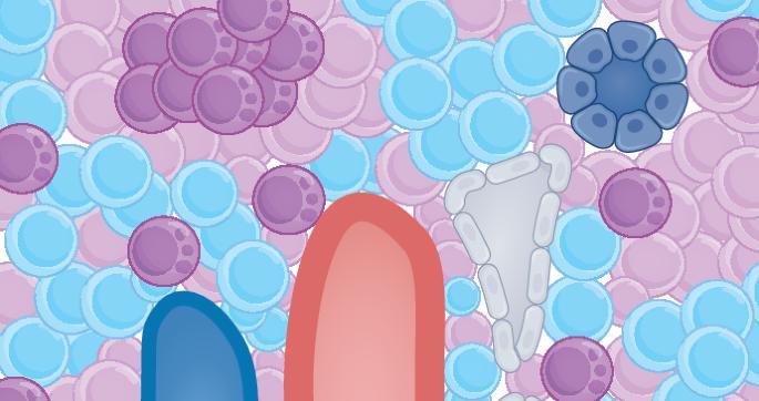 Tertiary lymphoid organs contribute to kidney allograft rejection