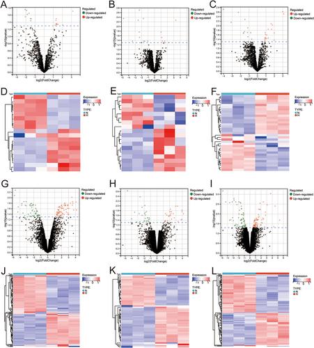 Identification and analysis of epithelial-mesenchymal transition-related key long non-coding RNAs in hypospadias