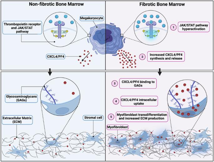 Proteomic screening identifies PF4/Cxcl4 as a critical driver of myelofibrosis