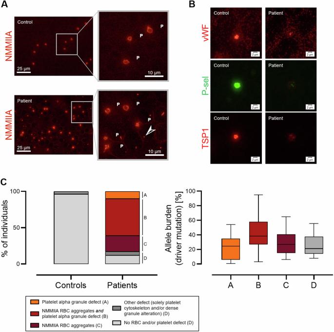 Immunofluorescence microscopy on the blood smear identifies patients with myeloproliferative neoplasms