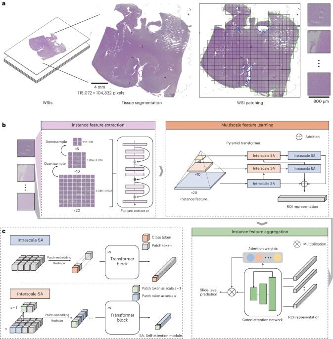 A transformer-based weakly supervised computational pathology method for clinical-grade diagnosis and molecular marker discovery of gliomas