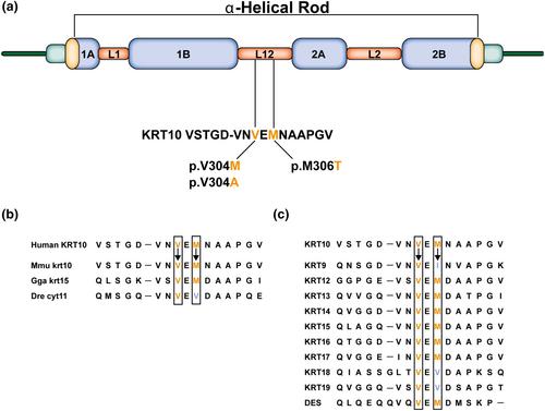 Variants in the L12 linker domain of KRT10 are causal to atypical epidermolytic ichthyosis