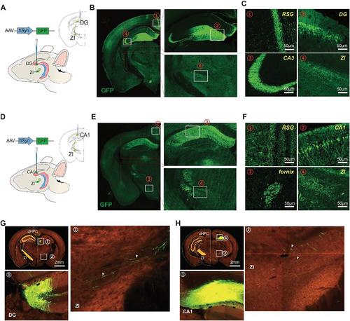 Identification of a Hippocampus-to-Zona Incerta Projection involved in Motor Learning