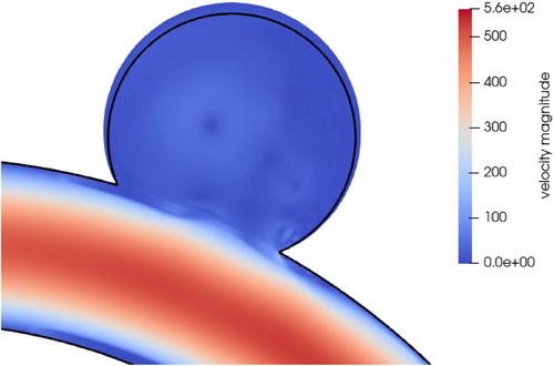 Numerical simulation of endovascular treatment options for cerebral aneurysms