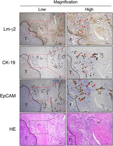 Hepatocyte transformation is induced by laminin γ2 monomer