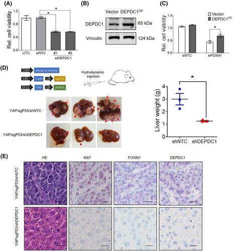 FOXM1/DEPDC1 feedback loop promotes hepatocarcinogenesis and represents promising targets for cancer therapy