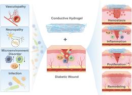 Conductive hydrogels as an “innovative healer” for the treatment of diabetic wounds