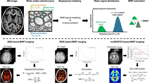 Harnessing myelin water fraction as an imaging biomarker of human cerebral aging, neurodegenerative diseases, and risk factors influencing myelination: A review