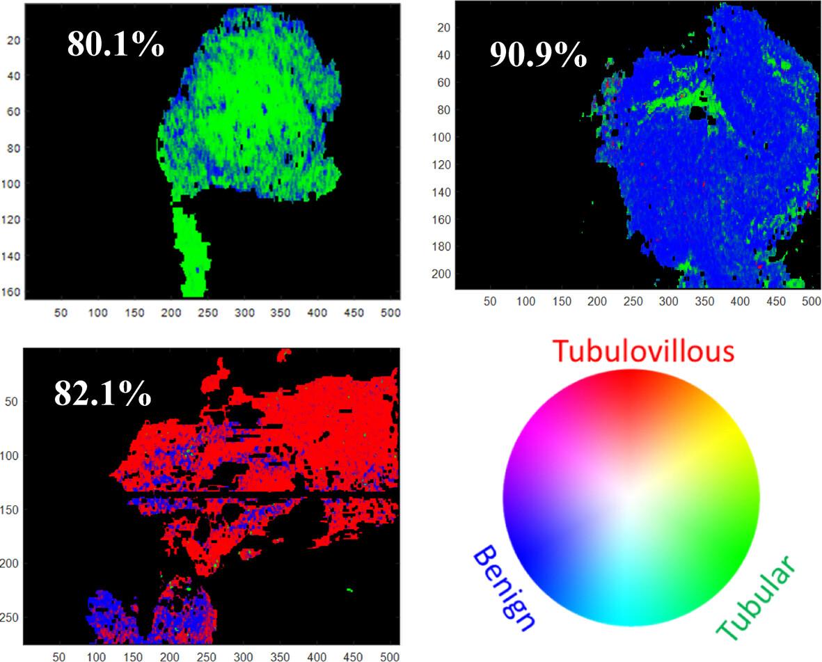 Deep learning classification of ex vivo human colon tissues using spectroscopic optical coherence tomography