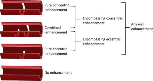 Contrast enhancement patterns associated with acute stroke in moyamoya disease using MR vessel wall imaging