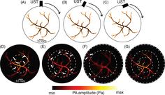 A practical solution to improve the field of view in circular scanning-based photoacoustic tomography