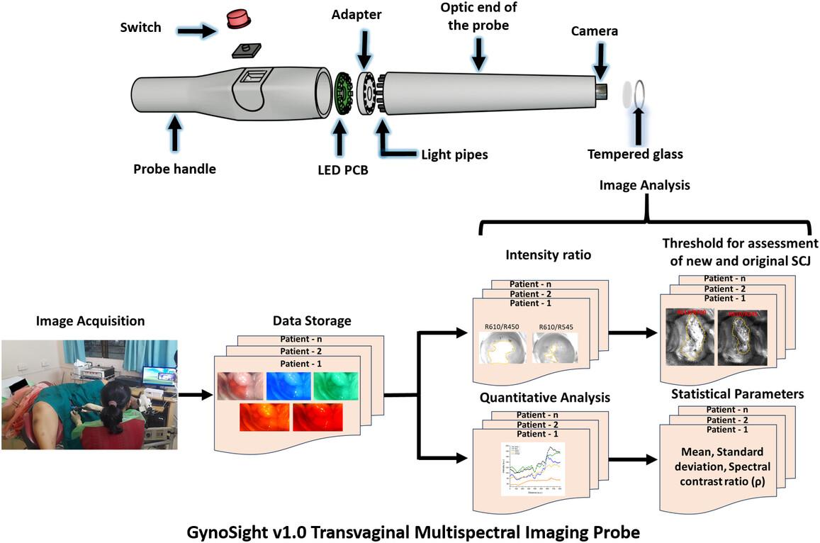 Label-free assessment of the transformation zone using multispectral diffuse optical imaging toward early detection of cervical cancer