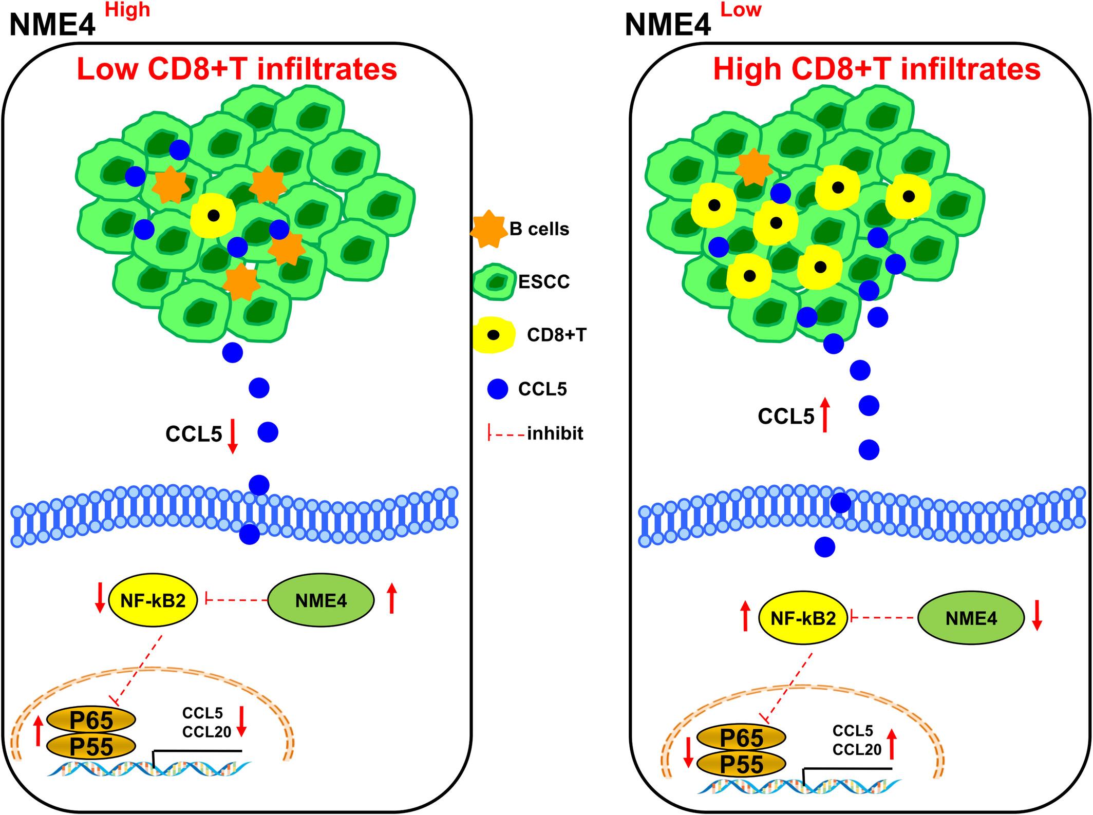 NME4 suppresses NFκB2-CCL5 axis, restricting CD8+ T cell tumour infiltration in oesophageal squamous cell carcinoma