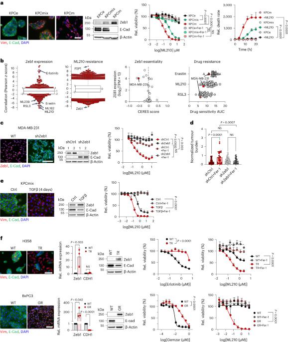 Zeb1 mediates EMT/plasticity-associated ferroptosis sensitivity in cancer cells by regulating lipogenic enzyme expression and phospholipid composition