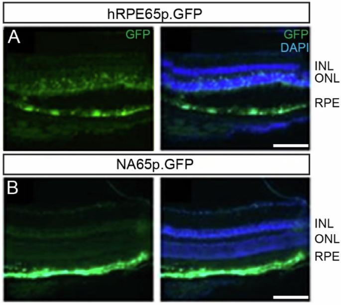 Correction: Development of an optimized AAV2/5 gene therapy vector for Leber congenital amaurosis owing to defects in RPE65