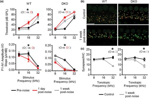 Pathophysiological processes underlying hidden hearing loss revealed in Kcnt1/2 double knockout mice