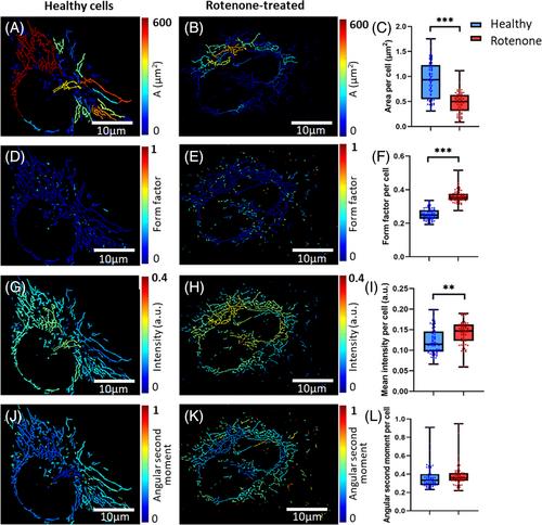 AutoMitoNetwork: Software for analyzing mitochondrial networks in autofluorescence images to enable label-free cell classification