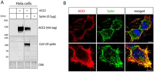 SARS-CoV-2 Spike Protein Induces Time-Dependent CTSL Upregulation in HeLa Cells and Alveolarspheres