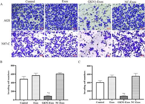 Gastrokine 1 transferred by gastric cancer exosomes inhibits growth and invasion of gastric cancer cells in vitro and in vivo